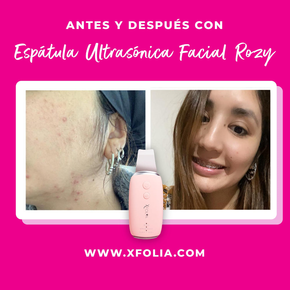 ROZY + SEBIBEAR DE REGALO 💓 PROMO