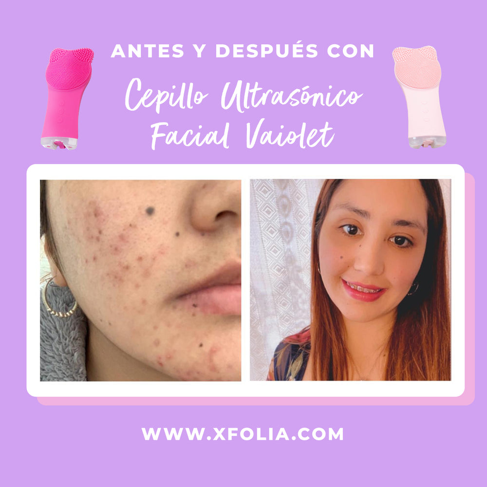 VAIOLET LIMPIADOR FACIAL ULTRASÓNICO FUCSIA