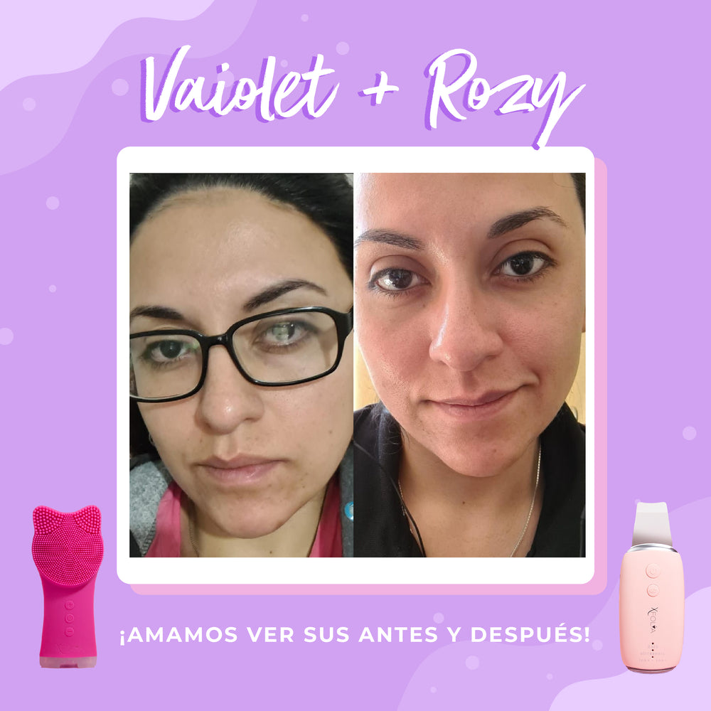 PACK ROZY + VAIOLET + CINTILLO OMG